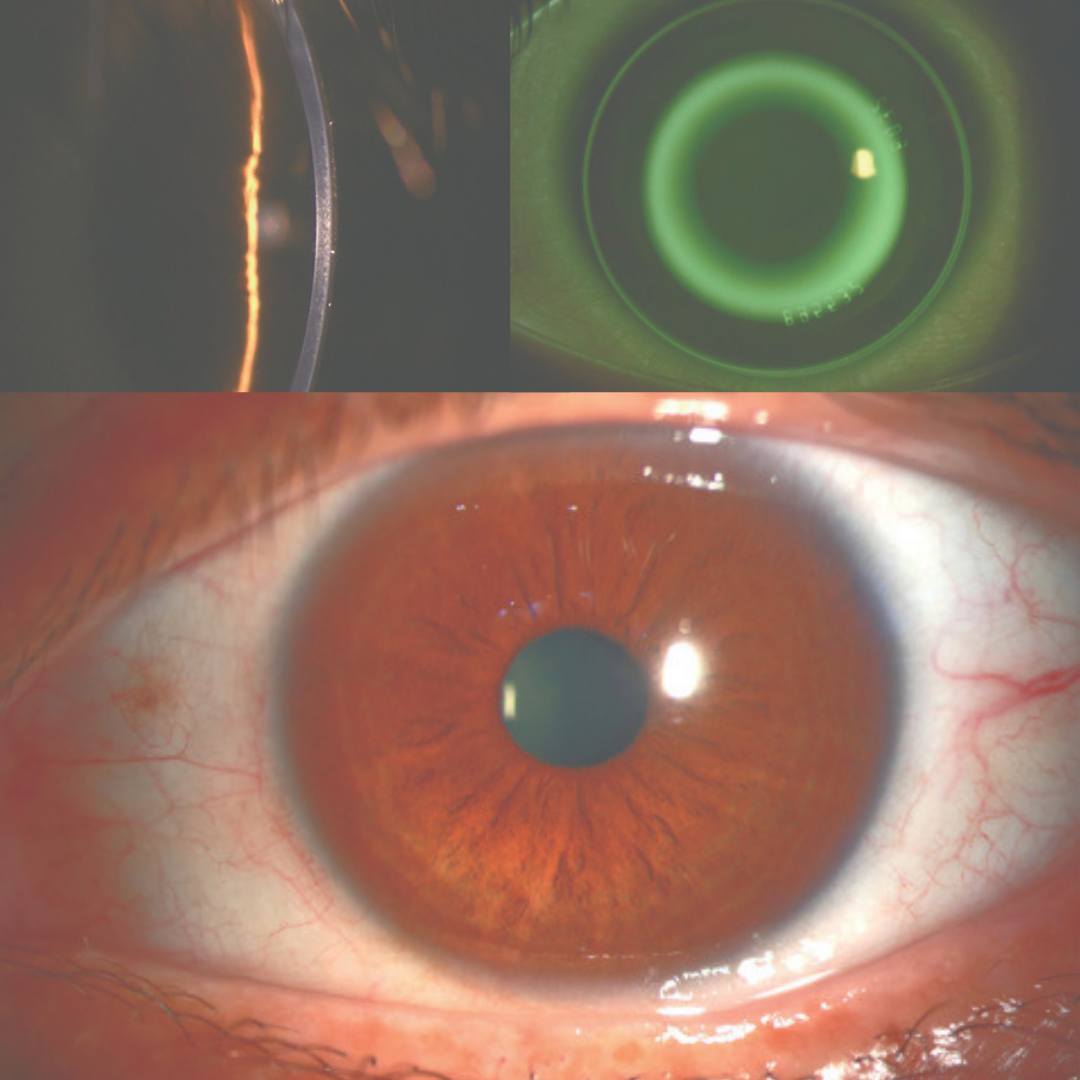 Exemplos de imagens Firefly WDR
